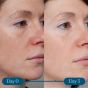 ELEMIS Dynamic Resurfacing Super-C Serum