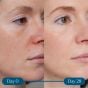 ELEMIS Dynamic Resurfacing Super-C Serum