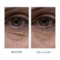 ELEMIS Peptide⁴ Eye Recovery Cream