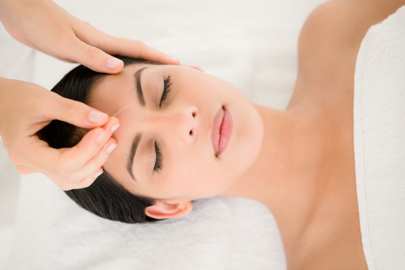 Balancing Your "Qi" With Acupuncture